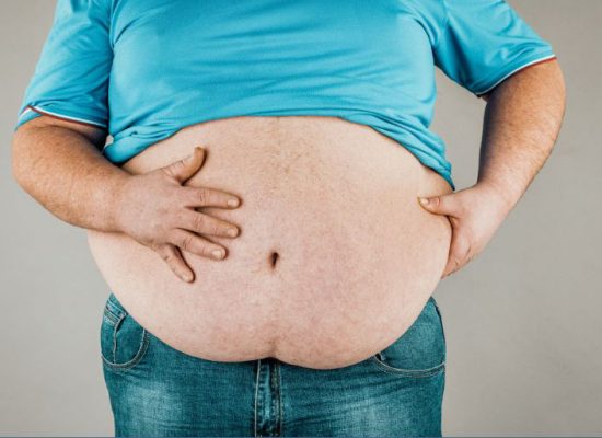 Definición y nuevos criterios diagnósticos de la obesidad clínica